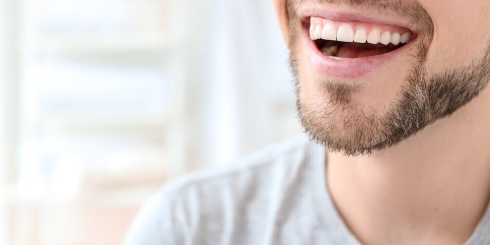 hollywood-smile-in-turkey