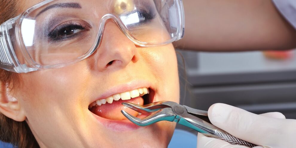 tooth-extraction-treatment-in-turkey