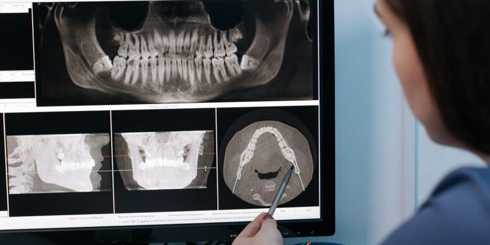 zirconia-or-porcelain-teeth